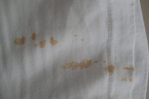 衣服上的石榴水怎么洗掉