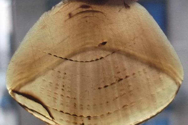 穿山甲鳞片治疗痛风吗?