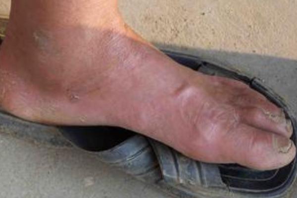 家里有蜈蚣怎么办?