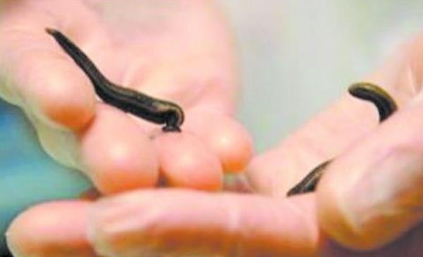被水蛭吸血疼吗 水蛭吸血后为什么死掉