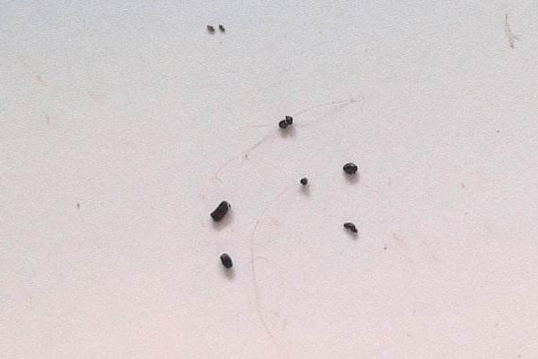 梦见拉屎在裤子里是什么意思 梦到拉屎在裤裆里有什么预兆