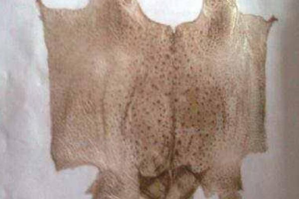 蟾衣的功效与作用及禁忌 蟾衣的药用价值