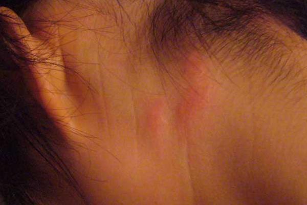 猫身上有虱子怎么办 猫虱子怎么去除